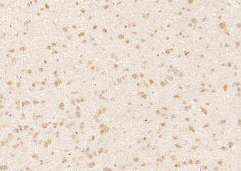 Phospho-c-ABL (Tyr204) Rabbit Polyclonal Antibody