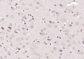 Phospho-c-ABL (Tyr245) Rabbit Polyclonal Antibody