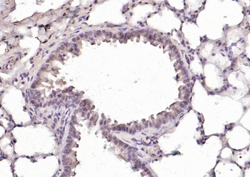 Phospho-c-ABL (Tyr245) Rabbit Polyclonal Antibody