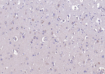 CACNA1G + CACNA1H Rabbit Polyclonal Antibody
