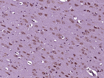 CaMK2 alpha Rabbit Polyclonal Antibody