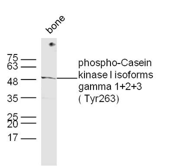 Phospho-CSNK1G 1+2+3 (Tyr263) Rabbit Polyclonal Antibody