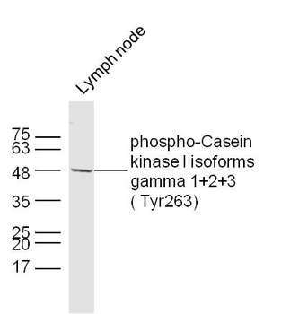Phospho-CSNK1G 1+2+3 (Tyr263) Rabbit Polyclonal Antibody