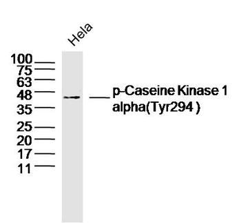 Phospho-Caseine Kinase 1 alpha (Tyr294) Rabbit Polyclonal Antibody