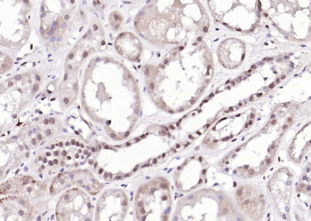 Caspase-6 subunit p11 Rabbit Polyclonal Antibody