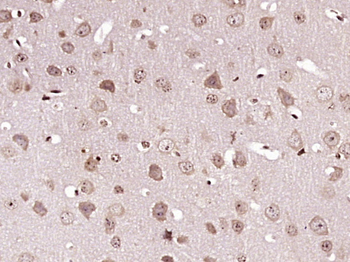 Caspase-6 subunit p11 Rabbit Polyclonal Antibody