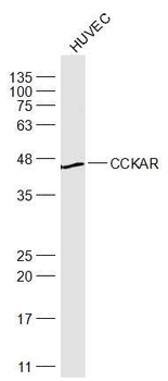 CCKAR Rabbit Polyclonal Antibody