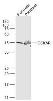 CCKAR Rabbit Polyclonal Antibody