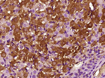 CCL26 Rabbit Polyclonal Antibody