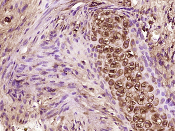 CCL26 Rabbit Polyclonal Antibody