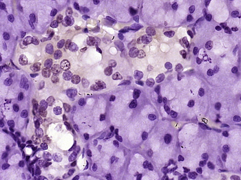 CCL26 Signal peptide Rabbit Polyclonal Antibody