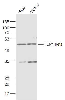 TCP1 beta Rabbit Polyclonal Antibody
