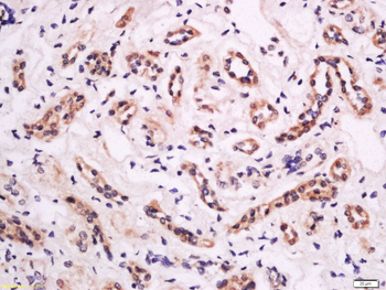 Phospho-ITGB2 (Thr758) Rabbit Polyclonal Antibody