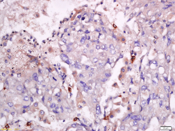 Phospho-ITGB2 (Thr758) Rabbit Polyclonal Antibody