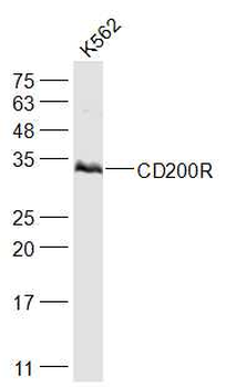 CD200R Rabbit Polyclonal Antibody