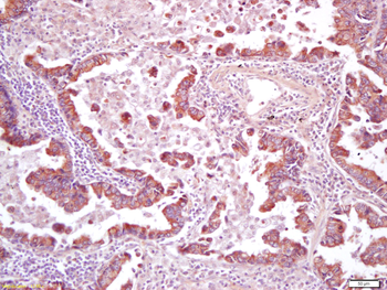 CD200R Rabbit Polyclonal Antibody