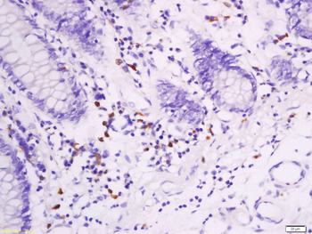 CD28 Rabbit Polyclonal Antibody