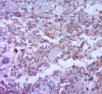 CD35 Rabbit Polyclonal Antibody