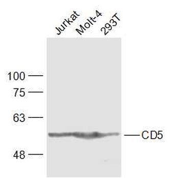 CD5 Rabbit Polyclonal Antibody