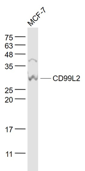 CD99L2 Rabbit Polyclonal Antibody