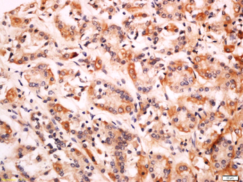 CD99L2 Rabbit Polyclonal Antibody