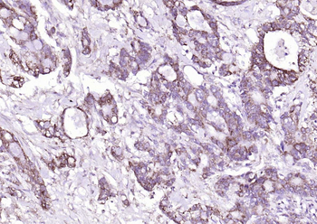 CEA Mouse Monoclonal Antibody