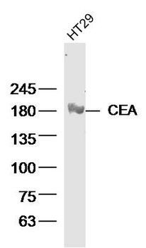 CEA Mouse Monoclonal Antibody