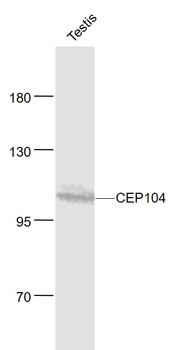 CEP104 Rabbit Polyclonal Antibody