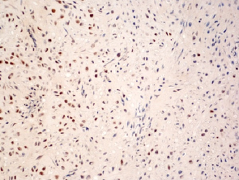 Phospho-c-Fos (Ser362) Rabbit Polyclonal Antibody