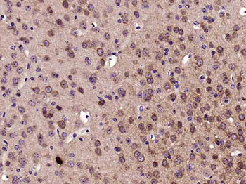 Phospho-c-Fos (Ser362) Rabbit Polyclonal Antibody
