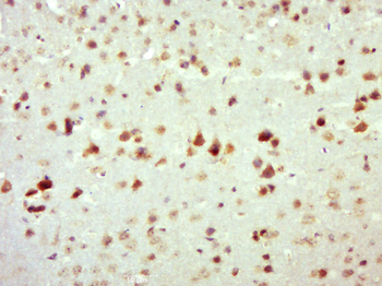 Phospho-c-Fos (Ser362) Rabbit Polyclonal Antibody