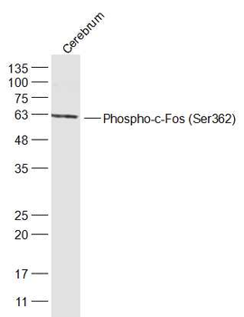 Phospho-c-Fos (Ser362) Rabbit Polyclonal Antibody