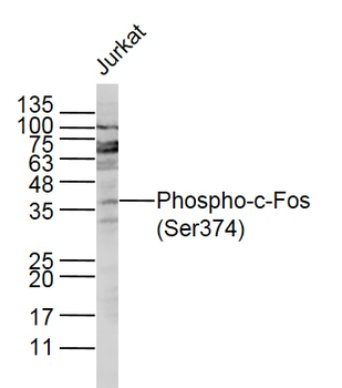 Phospho-c-Fos (Ser374) Rabbit Polyclonal Antibody