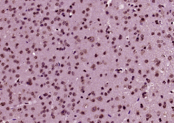 C-fos Rabbit Polyclonal Antibody