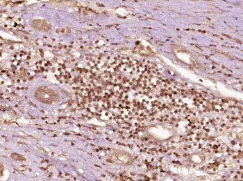 Phospho-CHEK1 (Ser296) Rabbit Polyclonal Antibody