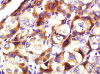 Chemerin Rabbit Polyclonal Antibody