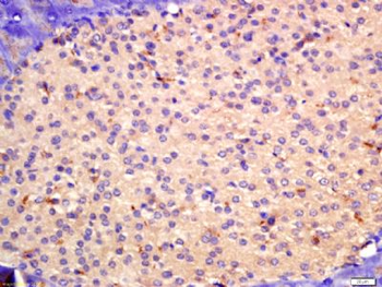 Chemerin Rabbit Polyclonal Antibody