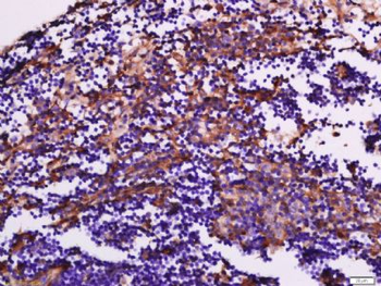 Chemerin Rabbit Polyclonal Antibody