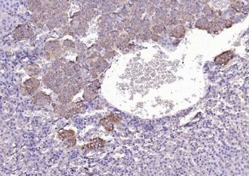 Chemerin Rabbit Polyclonal Antibody