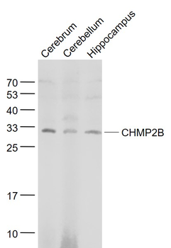 CHMP2B Rabbit Polyclonal Antibody