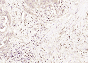 Phospho-CK II beta (Ser209) Rabbit Polyclonal Antibody