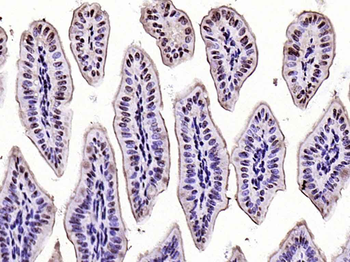 Phospho-CK18 (Ser52) Rabbit Polyclonal Antibody