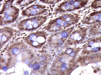 Phospho-CK18 (Ser52) Rabbit Polyclonal Antibody