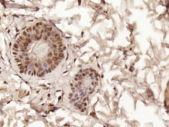 Phospho-CK18 (Ser52) Rabbit Polyclonal Antibody