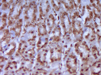 Phospho-CK18 (Ser52) Rabbit Polyclonal Antibody