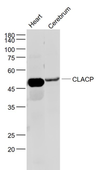 CLACP Rabbit Polyclonal Antibody