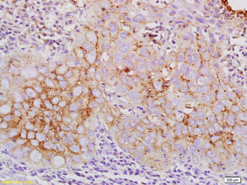 Claudin 10 Rabbit Polyclonal Antibody