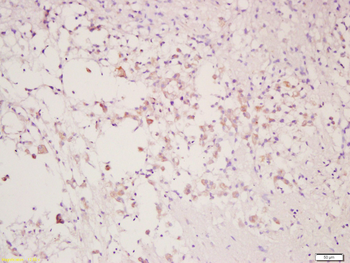 CLEC9A Rabbit Polyclonal Antibody