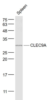 CLEC9A Rabbit Polyclonal Antibody