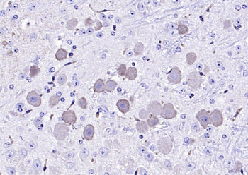 CLN8 Rabbit Polyclonal Antibody